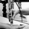 Low-Level-Laser Therapy (LLLT)