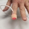 PPG  wearable devices
